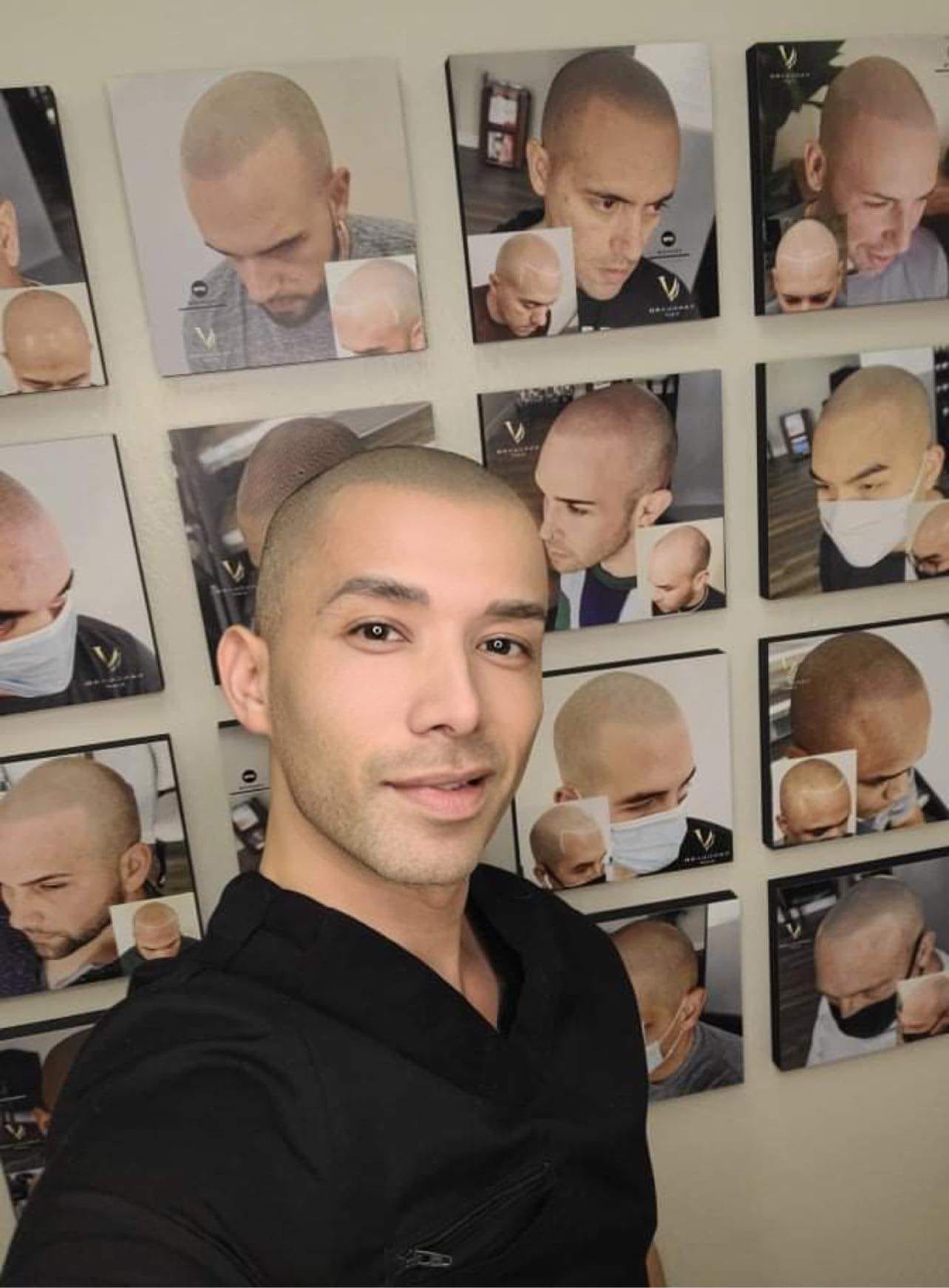 The owner of Vanguardsmp, and Scalp Micropigmentation Expert